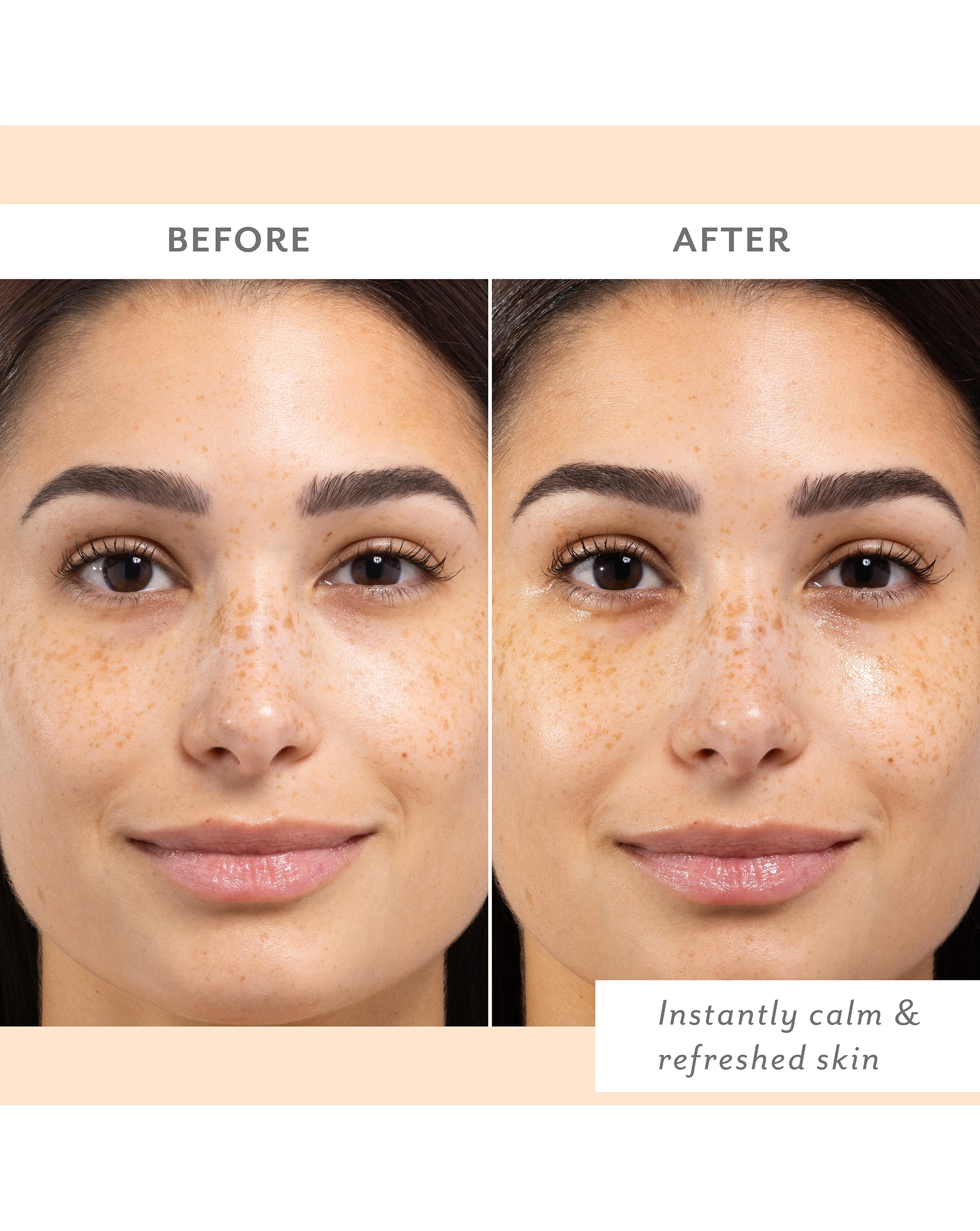 97510-patchology-skin-remedy-calm-amp-protect-mist-1.jpg